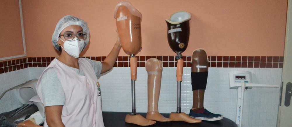 Prefeitura fornece cerca de 5 mil órteses, próteses e bolsas de ostomia