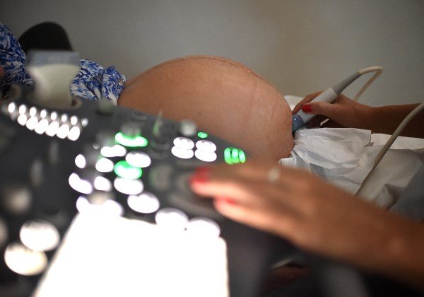 Fiocruz diz que, sem vacina, morte de grávidas será 4 vezes maior que em 2020