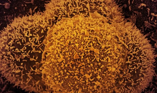 São Paulo identifica terceiro caso da subvariante BA.2