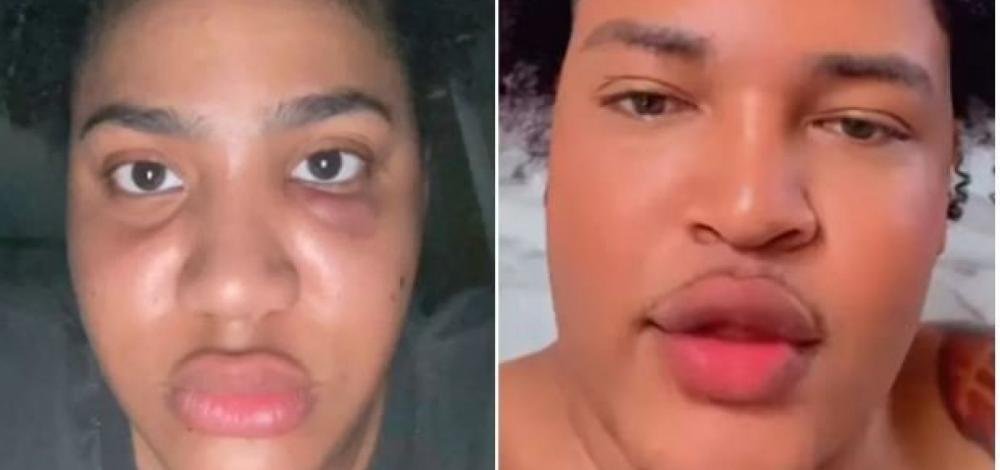 Influenciadora denuncia relacionamento abusivo com humorista baiano