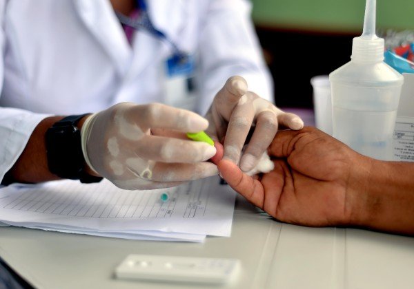 Testes positivos em farmácias cresceram 326% em maio