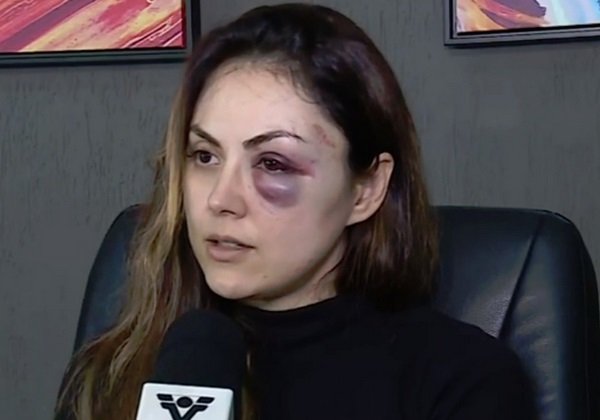 Justiça decreta prisão preventiva de servidor que espancou procuradora