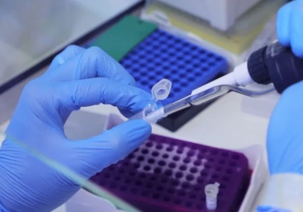 Varíola dos macacos: chega a 77 número de casos confirmados no Brasil