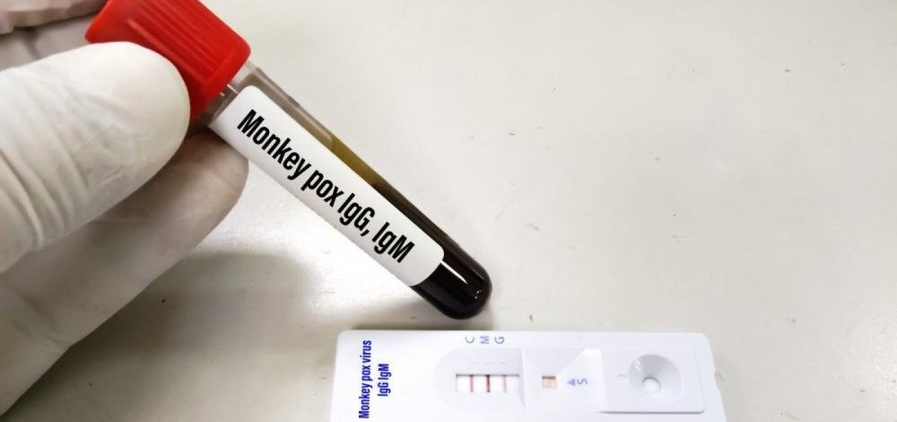 Salvador confirma novo caso de varíola dos macacos e total sobe para 13 na Bahia