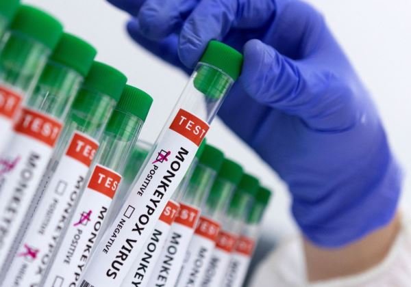 País realizou 8.850 testes de varíola dos macacos