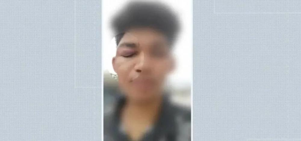 Estudante diz ter sido agredido com socos por oito seguranças de universidade no interior da Bahia