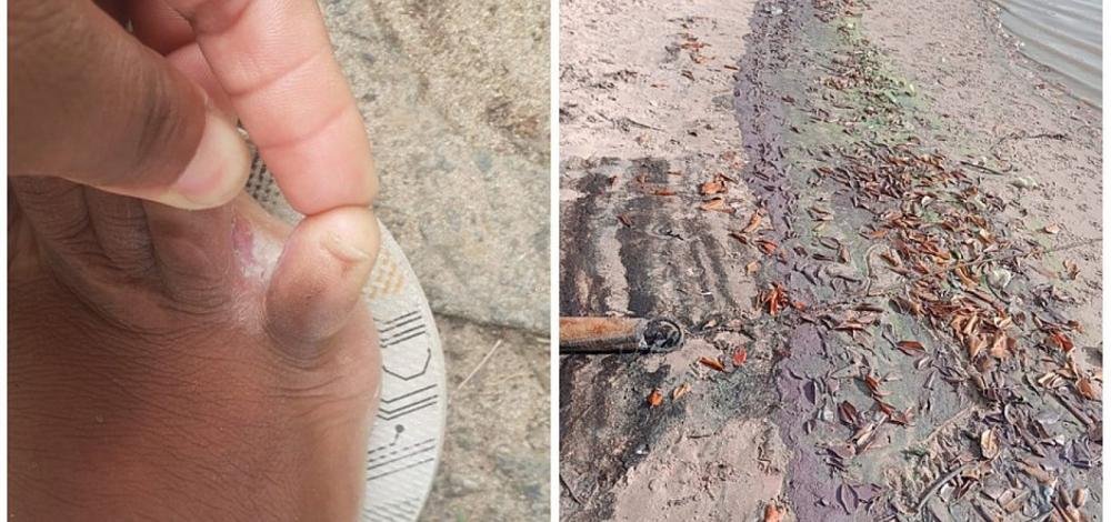 Pessoas sofrem coceira e mal-estar após contato com substância desconhecida em Barra do Jacuípe