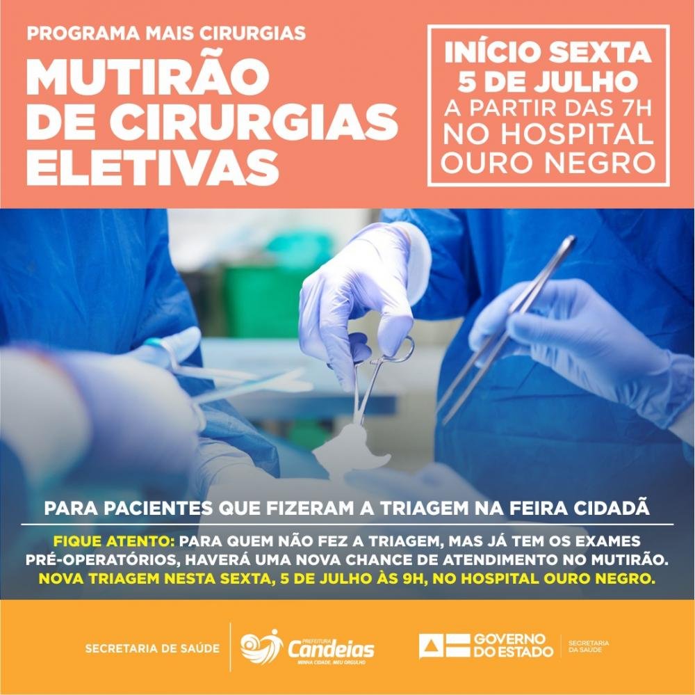 Candeias: Mutirão de cirurgias eletivas começa nesta sexta-feira