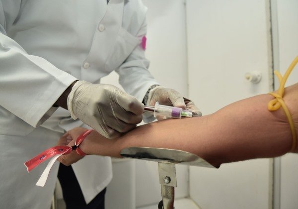 Prefeitura de Salvador inicia distribuição gratuita de autoteste para HIV