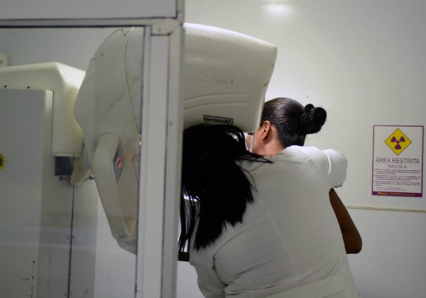 Mutirão gratuito oferece 120 vagas semanais para mamografia