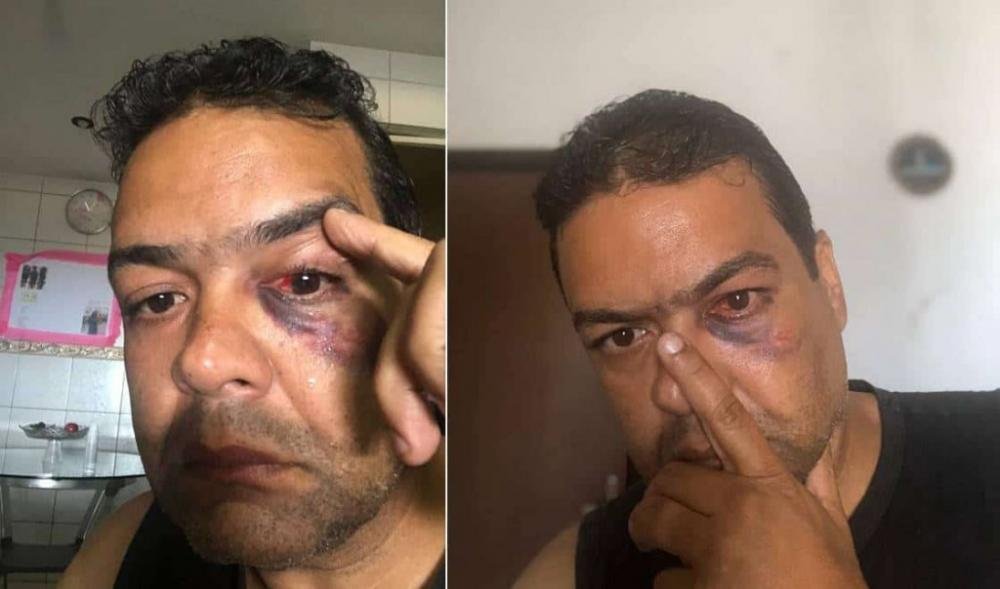 Simões Filho: Vereador renuncia cargos após ser agredido com socos por colegas 