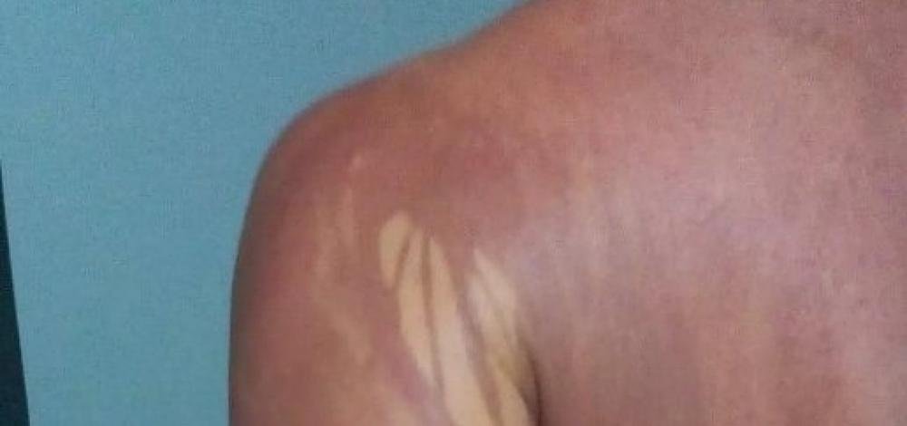 Dois casos suspeitos de intoxicação por óleo são investigados em Ilhéus