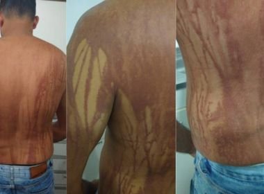 Ilhéus: Secretaria descarta intoxicação por óleo em turista mineiro