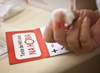 Bahia registra 736 novos casos de Aids em 2018