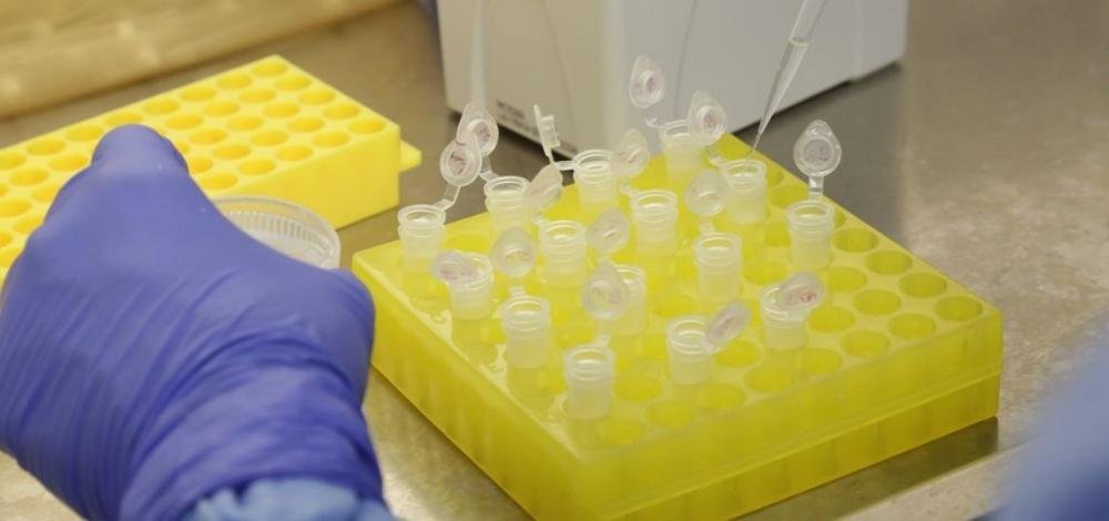 Cientistas da UFBA descobrem teste que detecta coronavírus em 3h