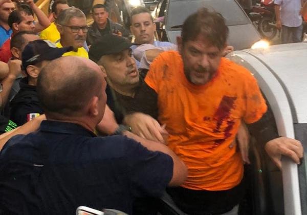 Cid Gomes deixa UTI após ser baleado em manifestação no Ceará