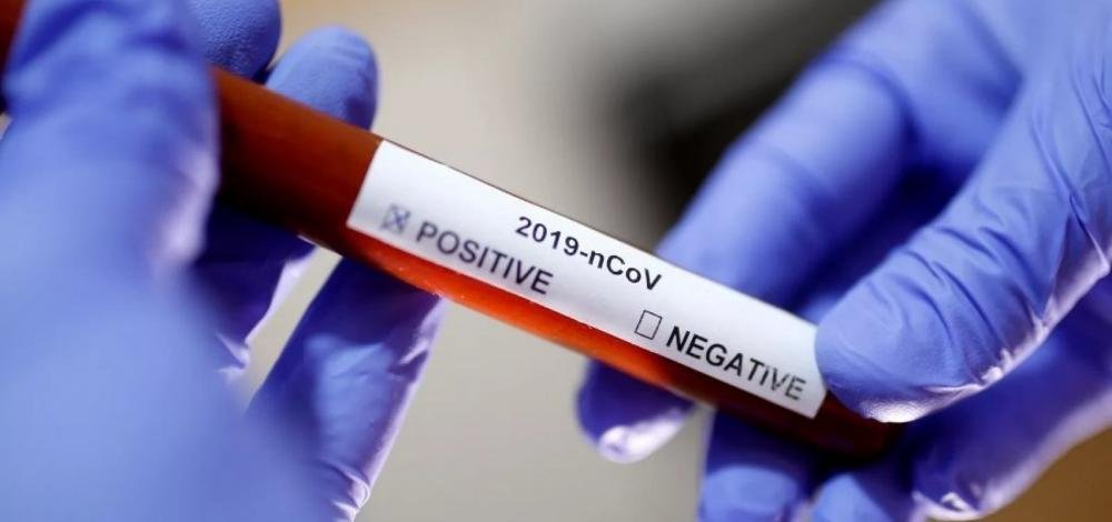 Governo divulga nota informativa às escolas da Bahia para prevenir infecção por coronavírus