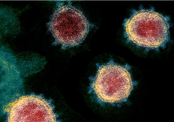 Estado tem 33 casos confirmados de coronavírus