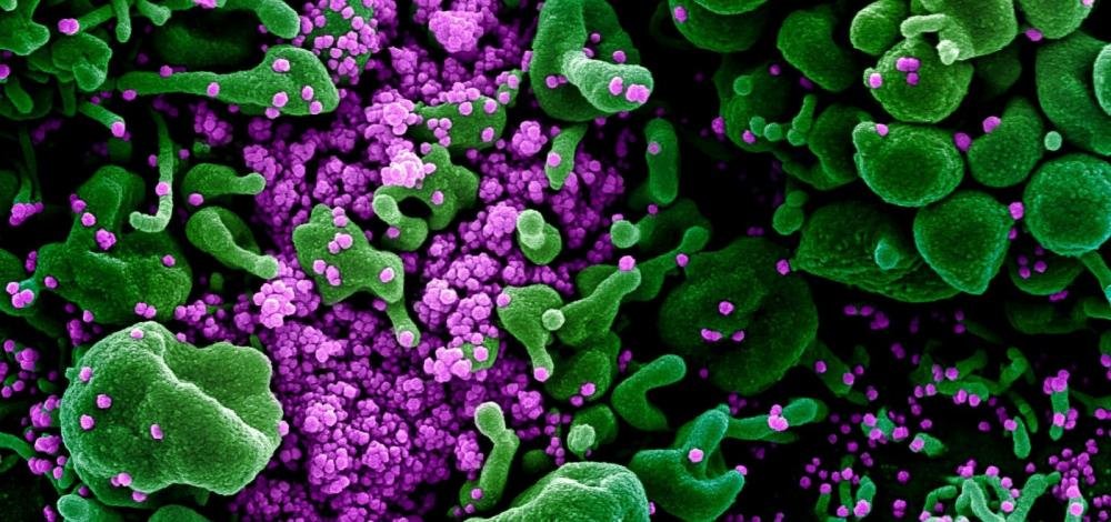 Mato Grosso registra 1º caso; coronavírus atinge 22 estados e o DF