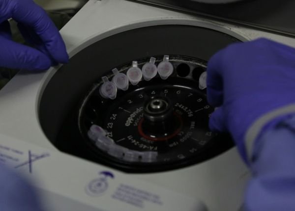 Estado já tem 34 casos de Covid – 19