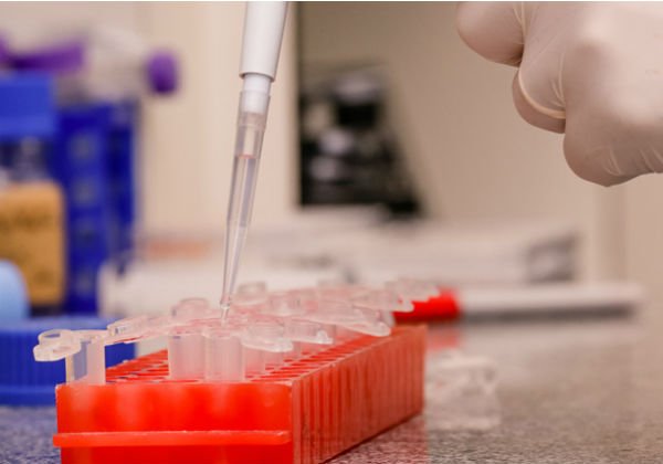 Estado registra oito casos em 12 horas e número de infectados por Covid-19 sobe para 49