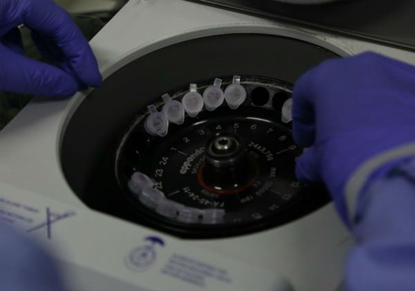 Estado tem 14 pacientes curados do novo coronavírus