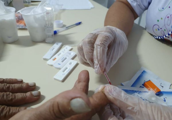 Coronavírus: estados começam a receber 500 mil testes rápidos