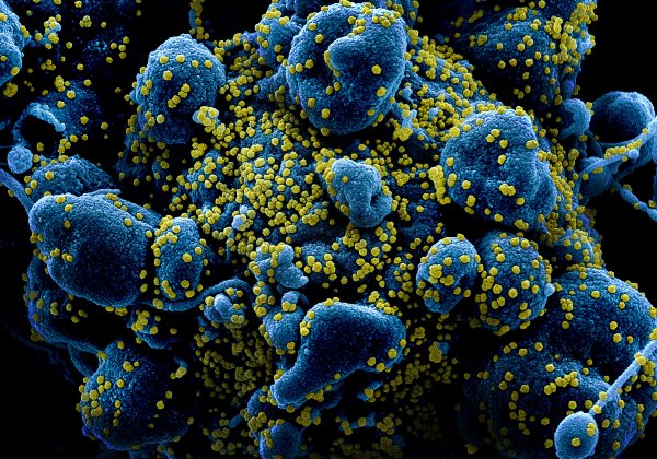 Coronavírus já mata mais que a Tuberculose