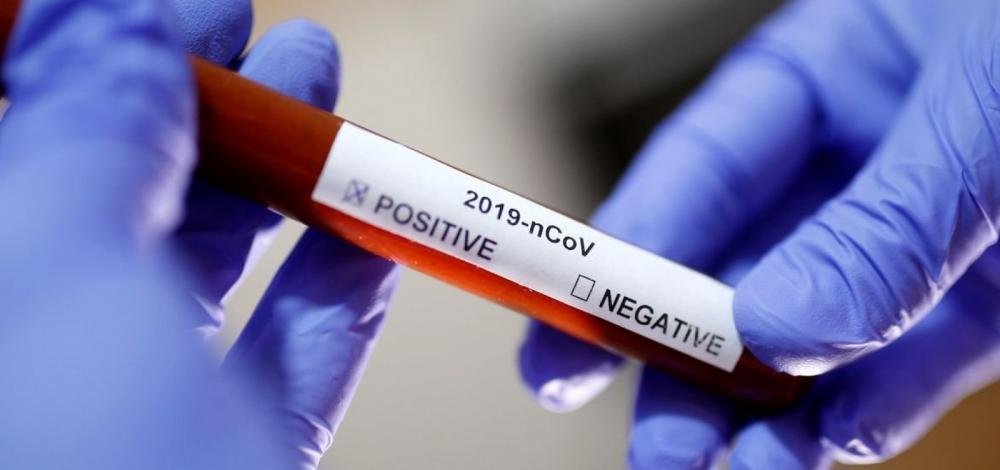 Bahia tem quinta morte pelo novo coronavírus