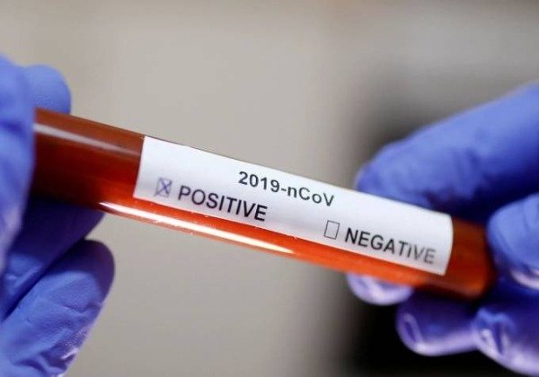 Bahia registra dois novos óbitos por Covid-19; um dos pacientes tinha 26 anos 