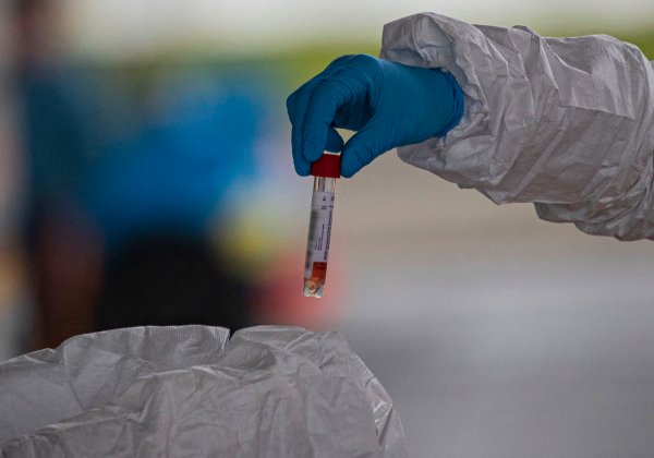 Bahia registra 776 casos confirmados de Covid-19