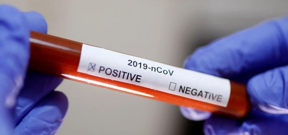 Lauro de Freitas: Mulher de 82 anos é a 33ª morte pelo novo coronavírus na Bahia