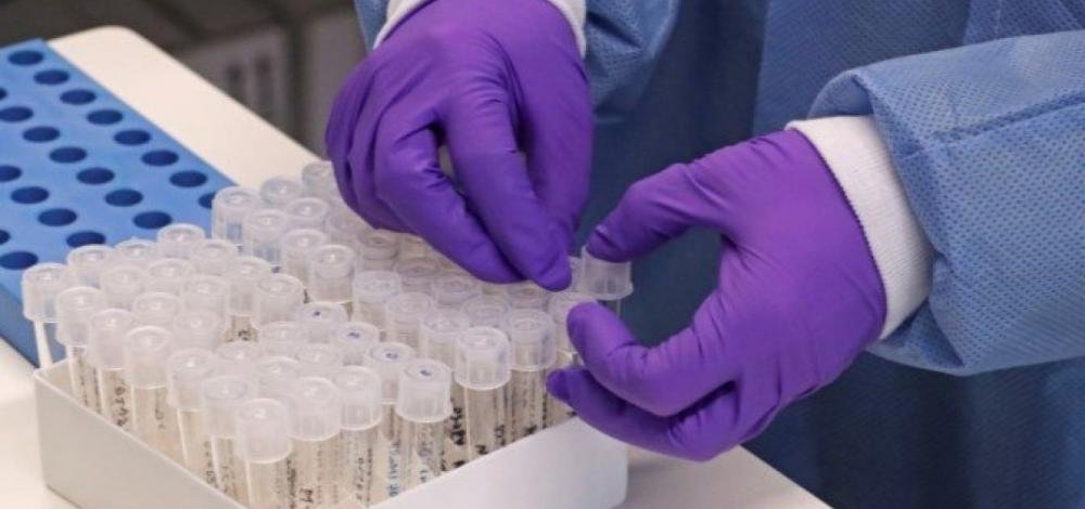 Coronavírus: Brasil registra 2.906 mortes e 45.757 casos confirmados