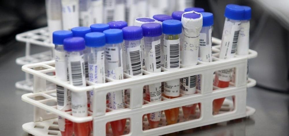 Coronavírus: Bahia registra cinco novas mortes e mais 227 casos