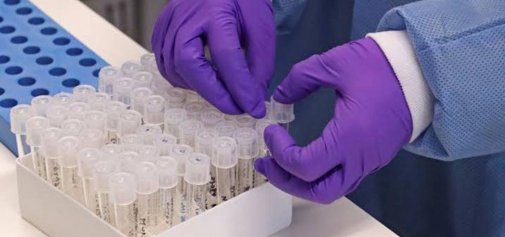 Bahia soma mais 458 novos casos de Covid-19 e Estado tem 5.546 diagnósticos