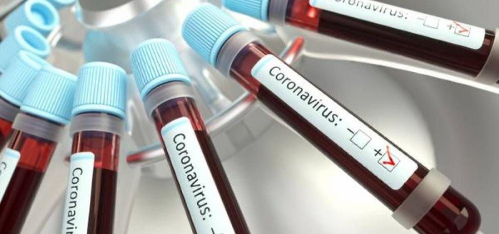 Bahia é o terceiro estado com mais aplicação de testes para Covid-19 no Brasil