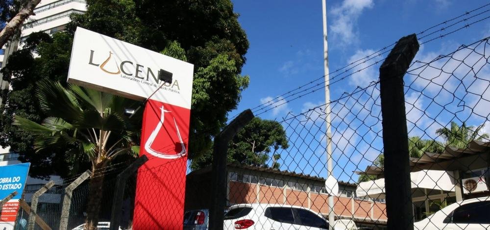 Sesab anuncia convocação de profissionais para atuar no Lacen