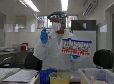  Mundo Covid-19: laboratório chinês testa medicamento que acelera cura de pacientes