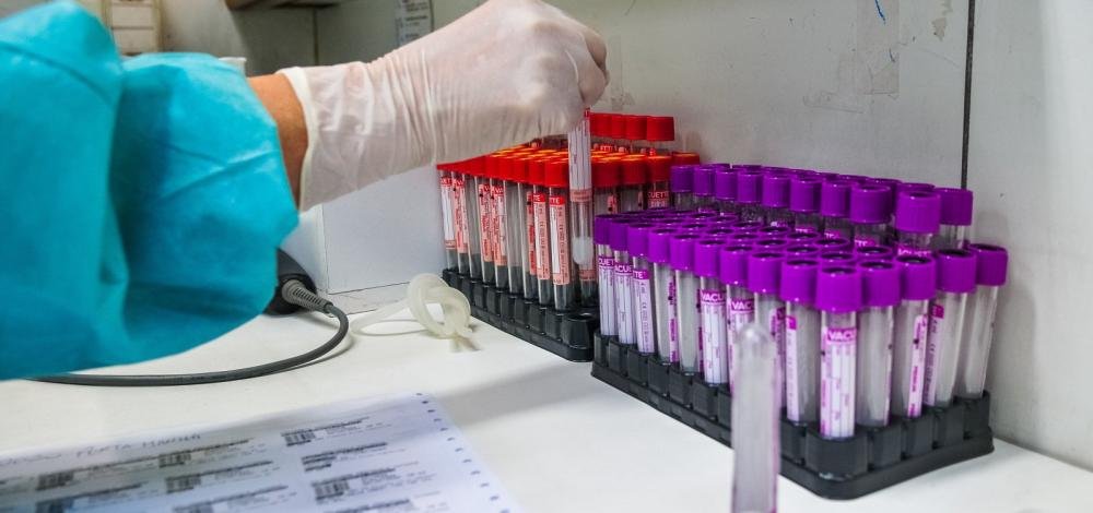 Chile ultrapassa 100 mil casos de coronavírus e acumula 1.113 mortos