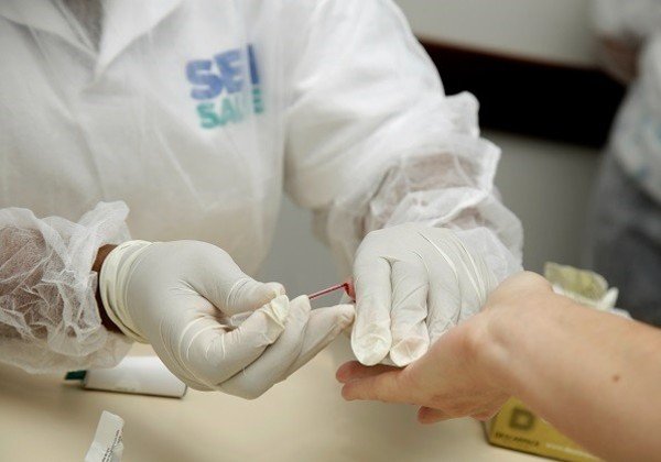 Sesi vai realizar 50 mil testes rápidos em indústrias baianas