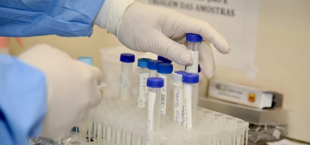 Imunidade ao novo coronavírus pode durar pouco tempo, diz estudo