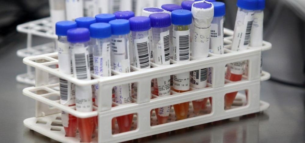 Governo divulga calendário de testes de Covid-19 em estudantes de Ipiaú, Uruçuca e Itajuípe