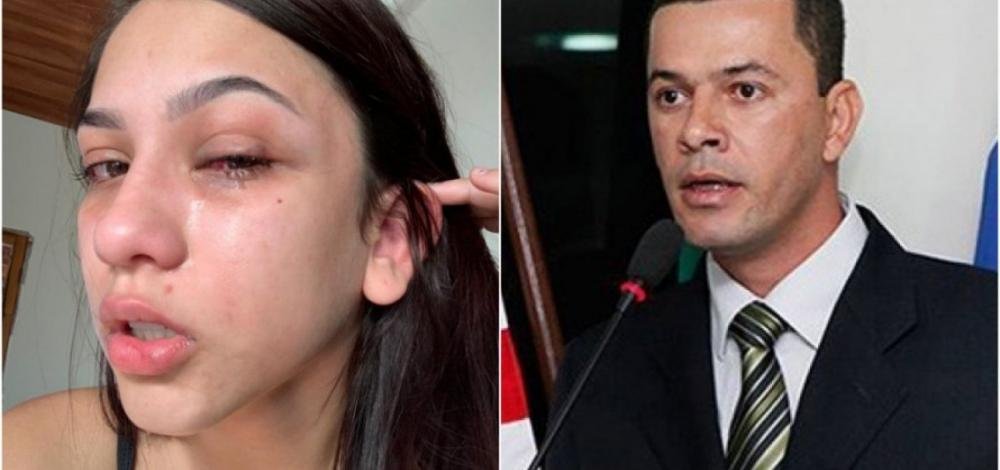 Campo Formoso: Presidente da Câmara é preso após agredir filha 