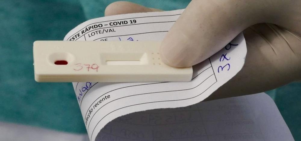 Ministério da Saúde obriga laboratórios a notificar em até 24h resultados de testes da Covid-19