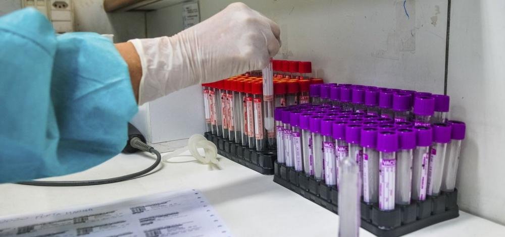 Pesquisa busca voluntários para avaliar relação entre genética e covid-19