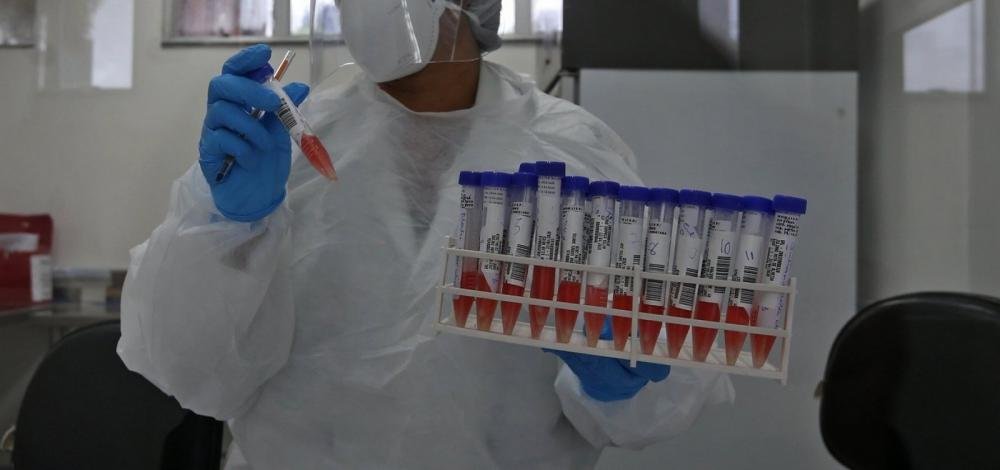 Resfriado comum pode dar imunidade contra a Covid-19, diz estudo americano