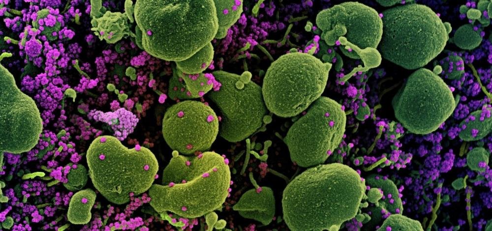 Menino de 9 anos é a primeira morte na Bahia por síndrome rara ligada à covid-19