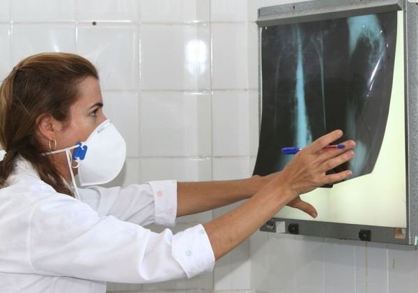 Fiocruz vai testar eficácia da vacina contra tuberculose para covid-19