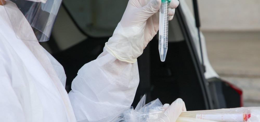 Novo coronavírus faz mais de 30 milhões de vítimas em todo o mundo