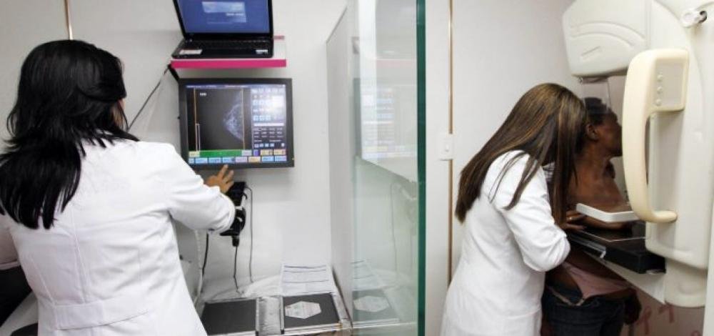 Sesab oferta dez mil mamografias com horário marcado em Salvador a partir de segunda-feira